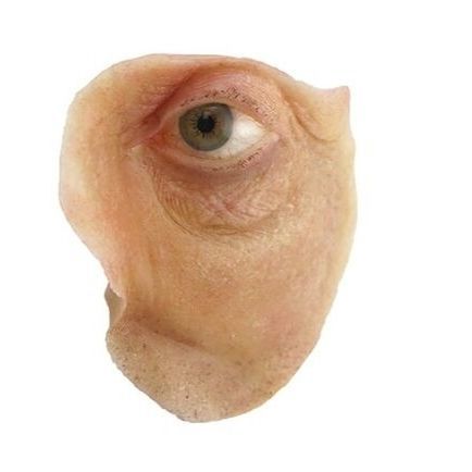 Kosmetische Orbitalprothese - The Anaplastology Clinic - für Erwachsene