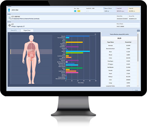 Datenmanagementsystem - DoseM - Infinitt Healthcare - Information / für medizinische Bildgebung / für Krankenhaus