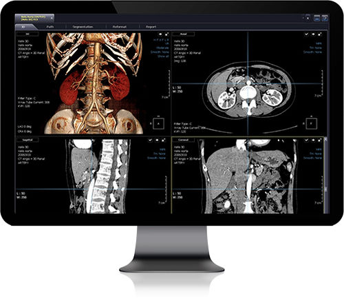 Software / dental- implantologische Planung - Xelis - Infinitt Healthcare - Reporting / Visualisierung / Diagnose