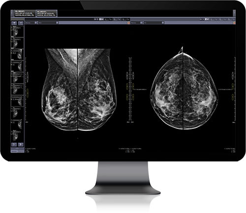 Diagnose-Software - Infinitt Healthcare - CAD / medizinisch / für PACS