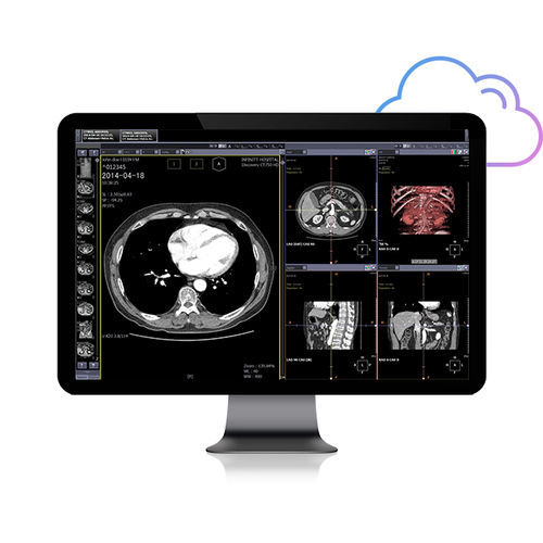 Webbasierter PACS - Smart Net - Infinitt Healthcare - medizinisch