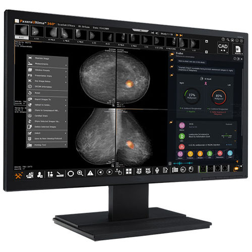 Medizinische Software - Paxera AI - PaxeraHealth Corp - Patientendaten / Computertomographie / für Radiologie