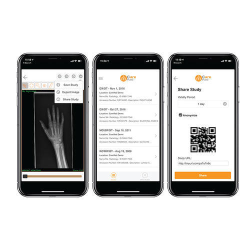 Content-Sharing-Software - CareRad - PaxeraHealth Corp - Bildanalyse / Management / Steuerung