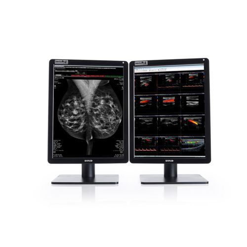 Diagnose-Monitor - MDNC-6121 - Barco - für Radiologie / Mammographie / hochauflösend