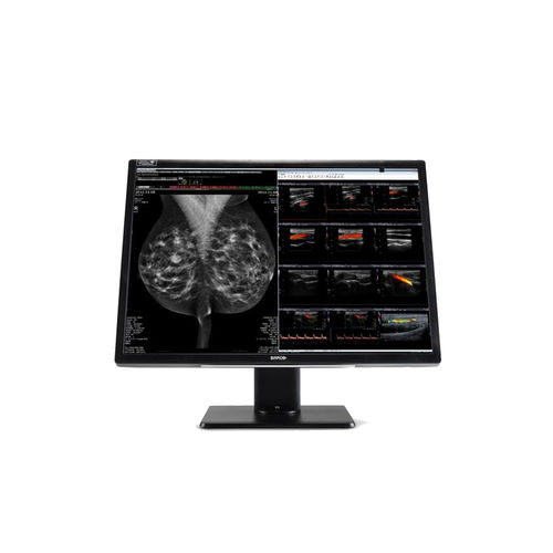 Medizinisch Monitor - MDNC‑12130 - Barco - Diagnose / Mammographie / hochauflösend