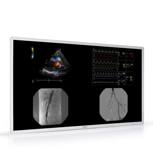 Medizinisch Monitor - MDAC-8355 - Barco - für Radiologie / hochauflösend / 4K