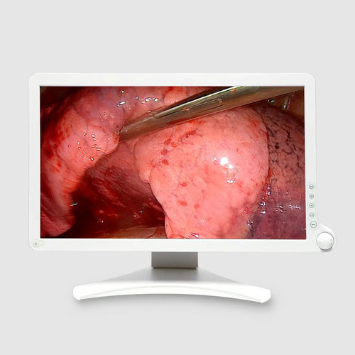 OP-Monitor - AMM 215WTD - Barco - für Endoskopie / HD / VGA
