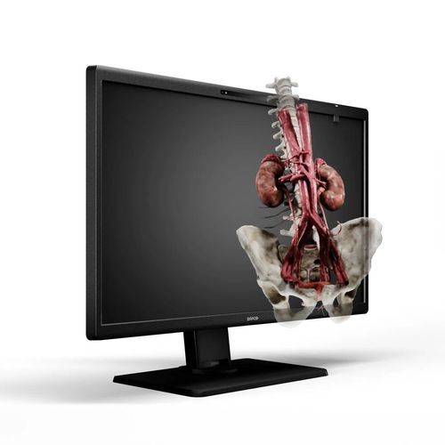 Medizinisch Monitor - Eonis 3D - Barco - OP / 8" / LED