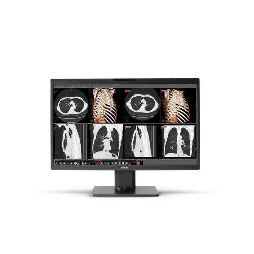 Medizinisch Monitor - Nio Color - Barco - für medizinische Bildgebung / Diagnose / für Radiologie