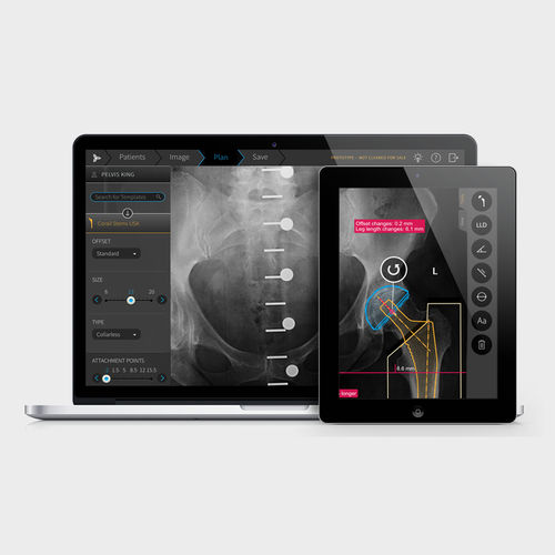 Medizinische Software - TraumaCad® - Brainlab - für Krankenhaus / Orthopädie / präoperativ
