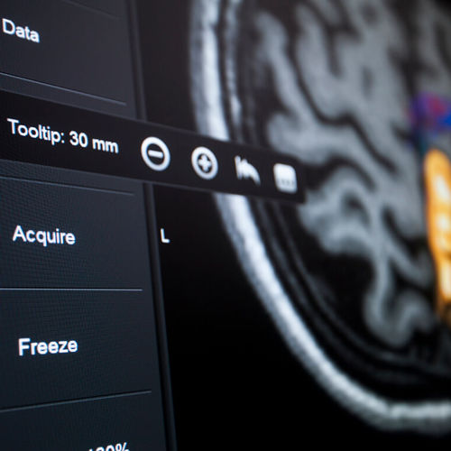 Software für Krankenhaus - Brainlab - für Neurochirurgie / Steuerung / Visualisierung