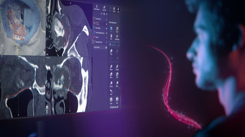 Medizinische Software - Brainlab - für Schädelchirurgie / für Chirurgie / für roboterassistierte Chirurgie
