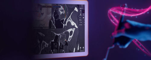 Medizinische Software - Brainlab - Computertomographie / für Chirurgie / Navigation