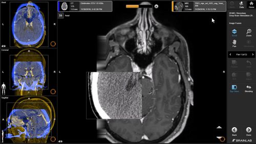 Medizinische Software - Brainlab - für Kliniken / Anatomie / OP