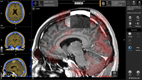 Medizinische Software - Brainlab - Neurologie / Planung / Behandlungsplanung
