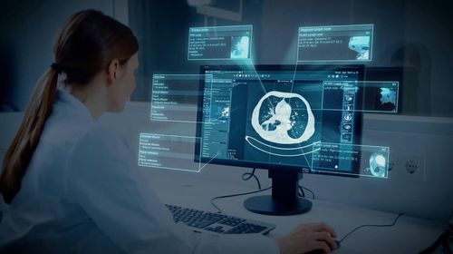Umform-Software - Brainlab - überwacht / medizinisch / Lungen