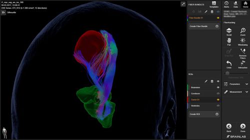 Medizinische Software - Elements  - Brainlab - für Neurochirurgie / Neurologie / Analyse