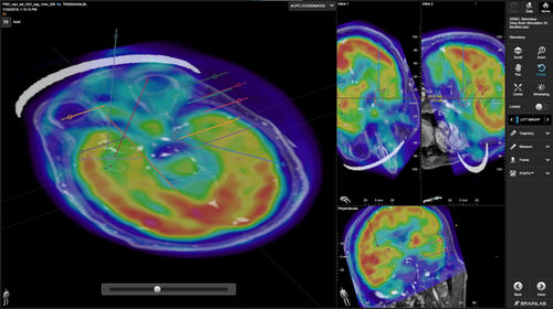Medizinische Software - Brainlab - für Kliniken / für Chirurgie / OP