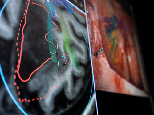 Software für Krankenhaus - Brainlab - für Chirurgie / für Operationsmikroskope / für roboterassistierte Chirurgie