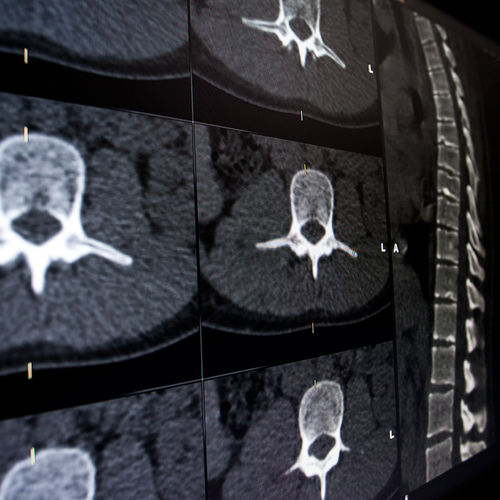 Medizinische Software - Brainlab - für Wirbelsäulenchirurgie / Neurologie / Visualisierung