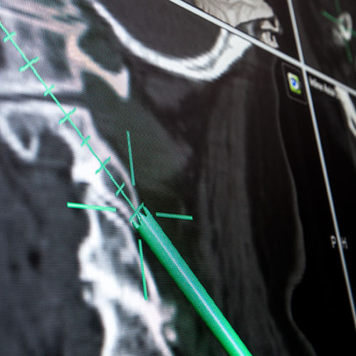 Software / chirurgische Navigation - Brainlab - medizinisch / für Krankenhaus / Computertomographie