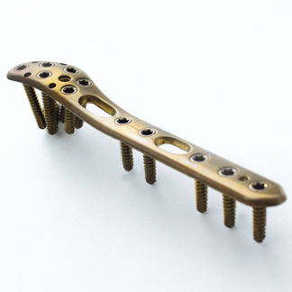 Kompressionsplatte für Fibula - 3.70 series - ChM - distal / mit Verriegelung / Metall