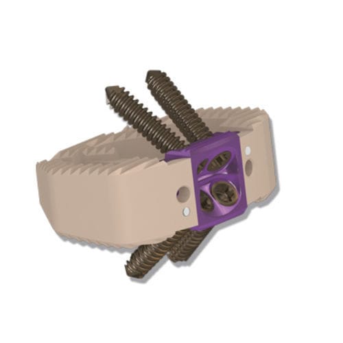 LWS-Zwischenwirbelimplantat - 15.0905.001 - ChM - ventraler Zugang / aus PEEK