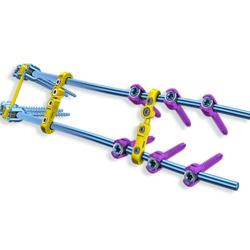 Thorako-lumbales Stabilisierungssystem für Osteosynthese - CHARSPINE2 - ChM - dorsaler Zugang / für Erwachsene