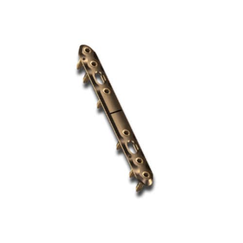 Kompressionsplatte für Radius - ChM - für Ulna / mit Verriegelung / Titan