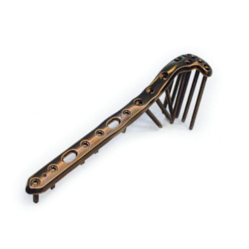 Kompressionsplatte für Tibia - ChM - proximal / seitlich / mit Verriegelung