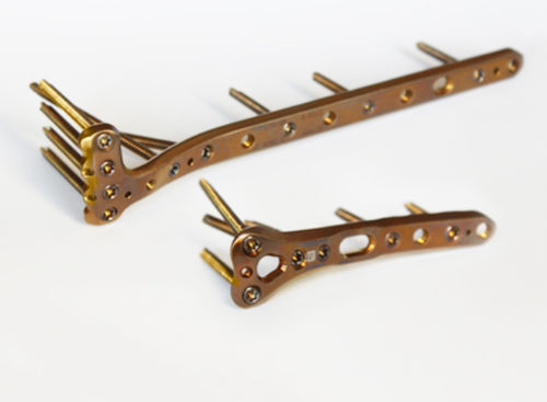 Kompressionsplatte für Tibia - 3.709 series - ChM - proximal / mit Verriegelung / Titan