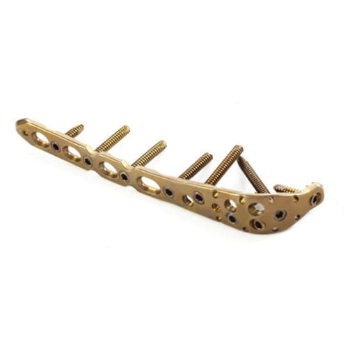 Kompressionsplatte für Olekranon - 3.409 series - ChM - distal / proximal / mit Verriegelung