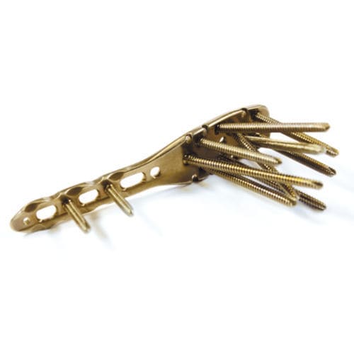 Kompressionsplatte für Humerus - 3.4034 series - ChM - proximal / mit Verriegelung / Titan