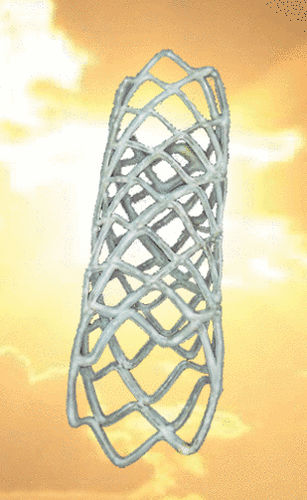 Peripherer Stent - REMEDY™ - Endocor - Metall