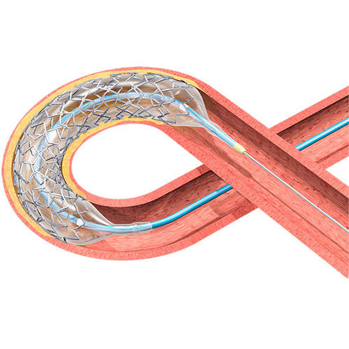 Koronararterien-Stent - BIOMATRIX ALPHA™ - Biosensors International - Kobaltchrom / medikamentenbeschichtet