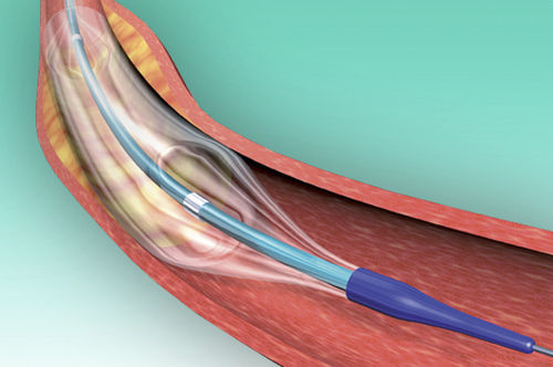 PTCA-Katheter - POWERLINE™ - Biosensors International - Koronar / Ballon / mit hydrophiler Beschichtung