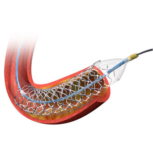 Koronararterien-Stent - BIOMATRIX NEOFLEX™ - Biosensors International - aus Edelstahl / medikamentenbeschichtet