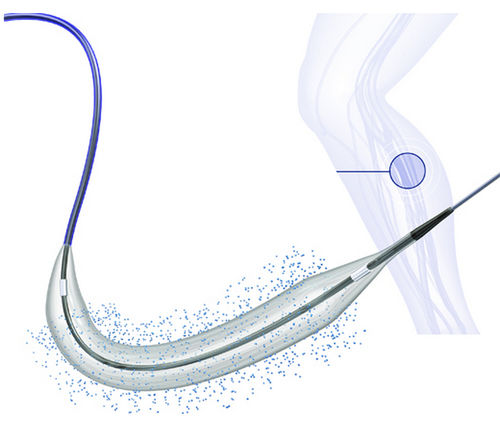 PTA-Katheter - BIOPATH™ 014 - Biosensors International - peripher / für Arterien / Femuraarterie