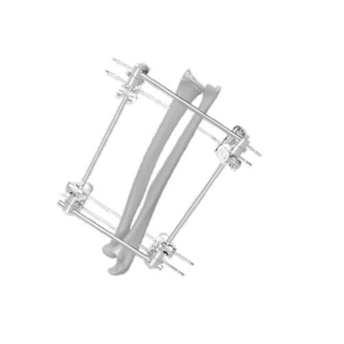 Fixateur externe / für Tibia - 201551 - SOFEMED International - für Fibula / rohrförmig / für Erwachsene