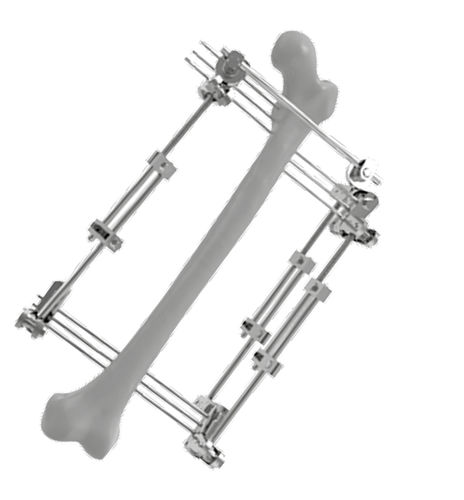 Fixateur externe / für Oberschenkelknochen - 201501 - SOFEMED International - rohrförmig / für Erwachsene