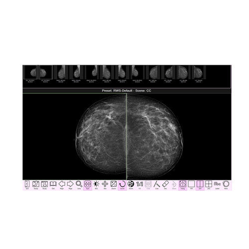 Software für Kliniken - RAFFAELLO  - IMS - für Mammographie / Bildanalyse / Beschaffung