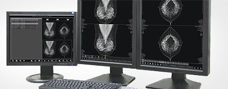 Computer-Arbeitsplatz / Diagnose - MammoVU - MEDI-FUTURE - für Mammographie