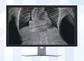 Visualisierungssoftware - MADXVIEW - Medonica - für Radiologie / für Tablet-PC