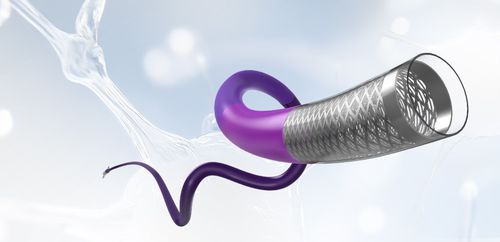 Ansaugender Katheter - Speedpass88™ - Medprin Biotech - neurovaskulär
