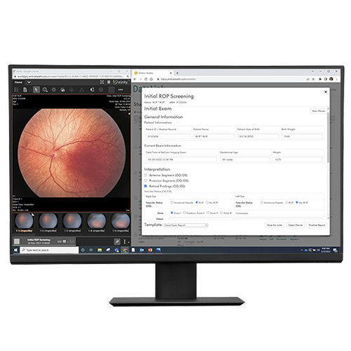 Datenverwaltungssoftware - DataLink  - Natus Medical - Diagnose / Reporting / Datenaustausch