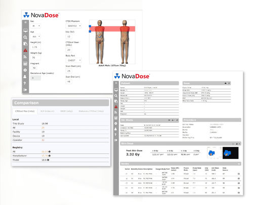 Software / Steuerung der Energiedosis - NovaDose®  - Novarad - für Kliniken / Computertomographie / MRT