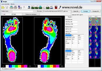 Podologie-Software - novel footpat®  - novel - Analyse