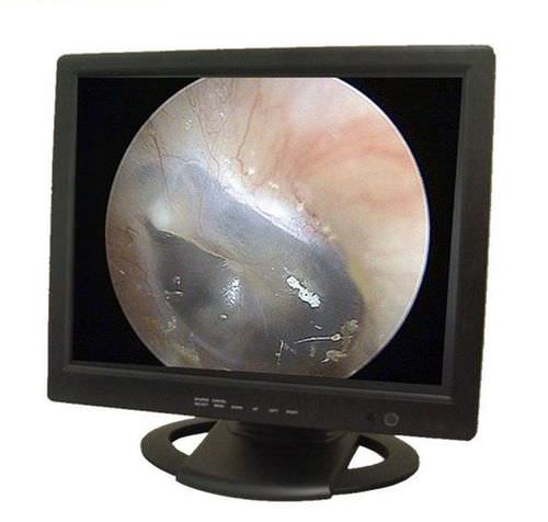 Monitor für Endoskopie - PROVIEW 19 - PROVIX  - 19" / LCD