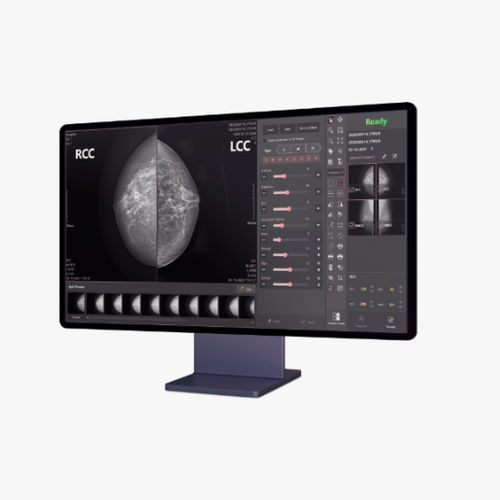 Medizinisches Computerprogramm - Xmaru W - Rayence - für Mammographie / Bildanalyse / Brust