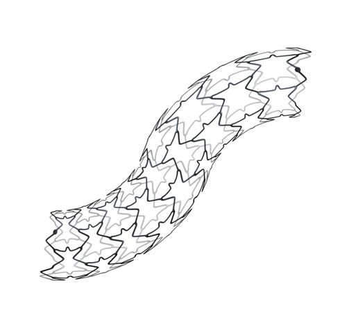 Nierenarterie-Stent - BMS B.E. – Radix2 - Alvimedica - aus Edelstahl